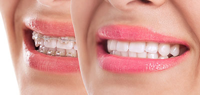 Murphy Dentistry | Veneers, Crowns  amp  Caps and CBCT