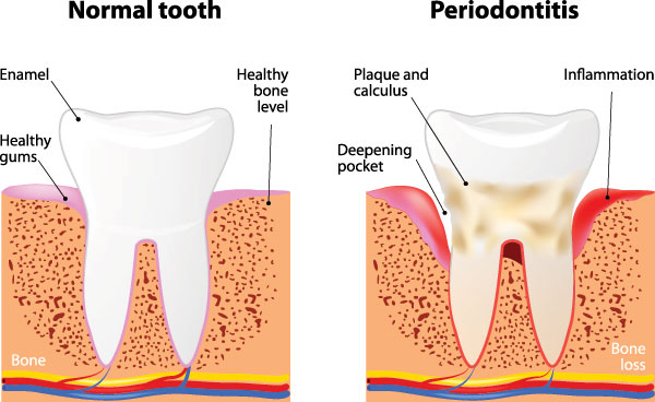 Murphy Dentistry | Digital Impressions, Sports Mouthguards and Dental Cleanings