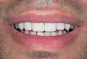 Murphy Dentistry | Sleep Apnea, Pediatric Dentistry and Implant Dentistry