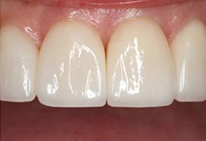 Murphy Dentistry | Crowns  amp  Caps, Implant Dentistry and CBCT
