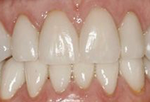 Murphy Dentistry | Dental Fillings, Dental Cleanings and Periodontal Treatment