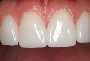 Murphy Dentistry | Dental Cleanings, Root Canals and Snoring Appliances