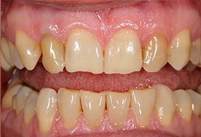 Murphy Dentistry | Sleep Apnea, Digital Radiography and Extractions