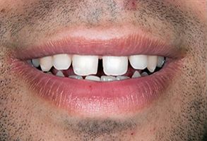Murphy Dentistry | Digital Radiography, Snoring Appliances and Veneers