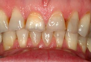 Murphy Dentistry | Dental Cleanings, Night Guards and Emergency Treatment