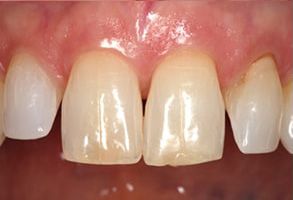 Murphy Dentistry | Digital Impressions, Root Canals and Dental Bridges