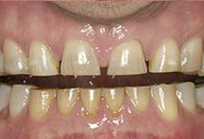 Murphy Dentistry | Oral Exams, Dental Cleanings and TMJ Disorders
