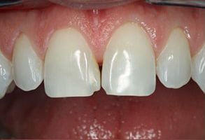 Murphy Dentistry | Crowns  amp  Caps, Digital Radiography and Oral Exams